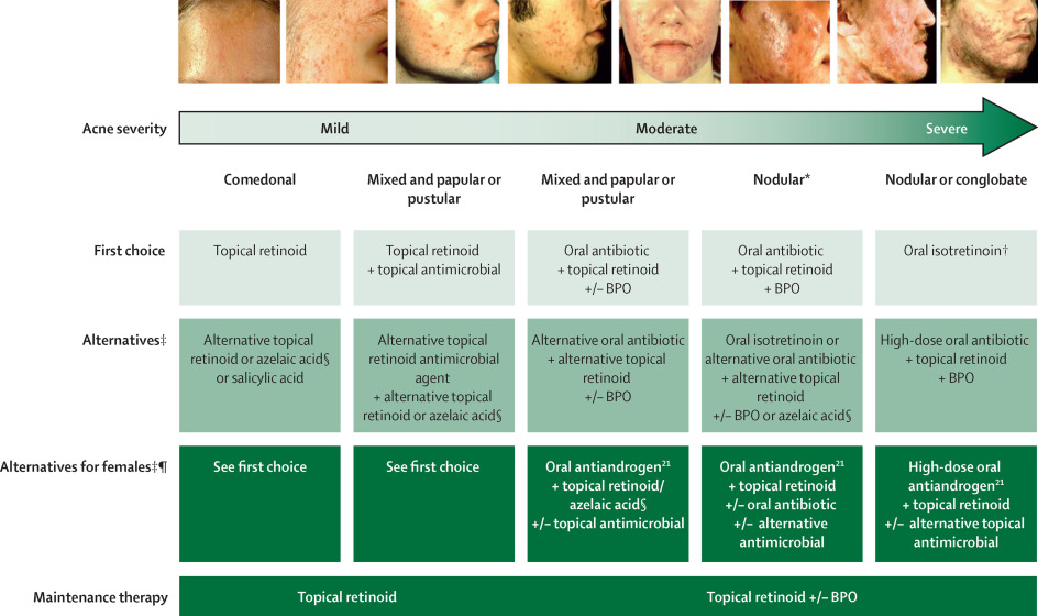 Acne Algorithm From The Global Alliance Algorithm To Improve Outcomes ...